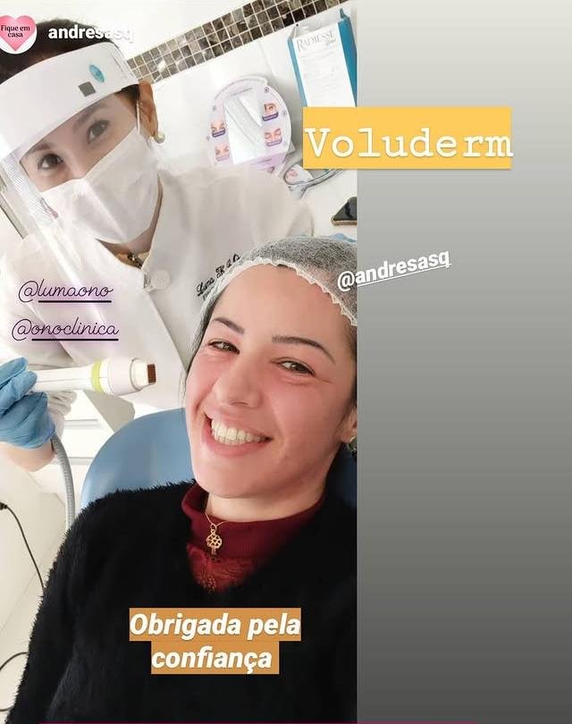 Radiofrequência fracionada aplicada por Luma Ono